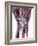 Fractured Wrist, X-ray-Du Cane Medical-Framed Photographic Print