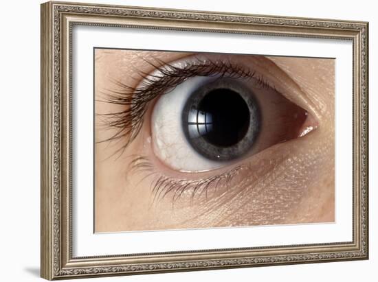 Front View of Human Eye with Dilated Pupil-Adam Hart-Davis-Framed Photographic Print