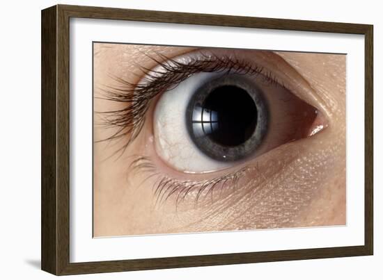 Front View of Human Eye with Dilated Pupil-Adam Hart-Davis-Framed Photographic Print