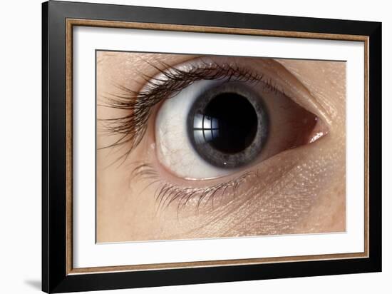 Front View of Human Eye with Dilated Pupil-Adam Hart-Davis-Framed Photographic Print