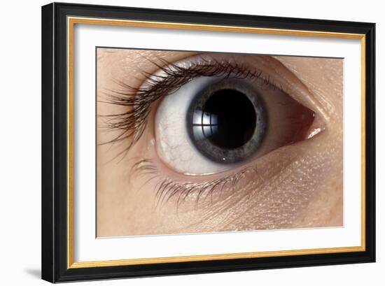 Front View of Human Eye with Dilated Pupil-Adam Hart-Davis-Framed Photographic Print