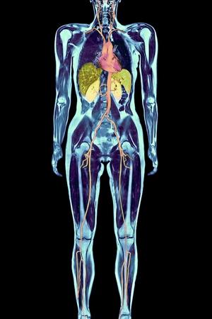 Full Body Scan, MRI Scan' Photographic Print - Volker Steger | Art.com