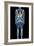 Full Body Scan, MRI Scan-Volker Steger-Framed Photographic Print