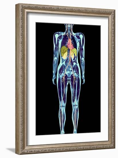 Full Body Scan, MRI Scan-Volker Steger-Framed Photographic Print