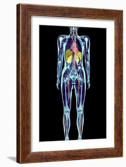 Full Body Scan, MRI Scan-Volker Steger-Framed Photographic Print