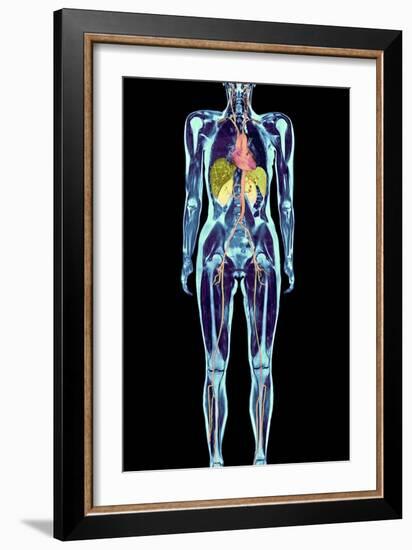 Full Body Scan, MRI Scan-Volker Steger-Framed Photographic Print