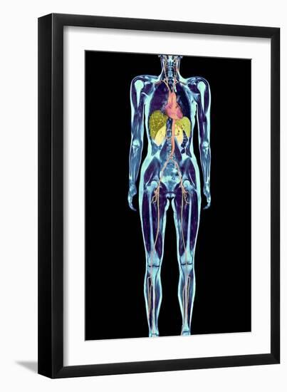 Full Body Scan, MRI Scan-Volker Steger-Framed Photographic Print