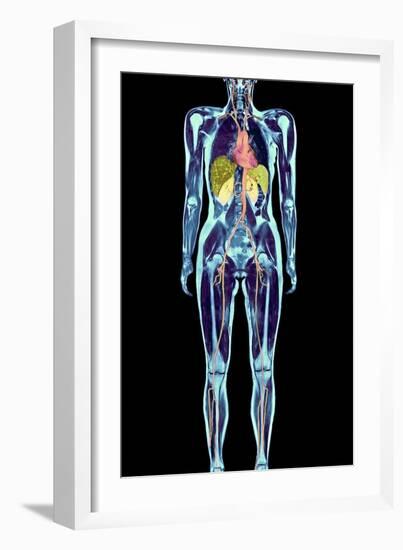 Full Body Scan, MRI Scan-Volker Steger-Framed Photographic Print