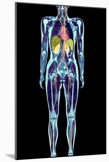 Full Body Scan, MRI Scan-Volker Steger-Mounted Photographic Print