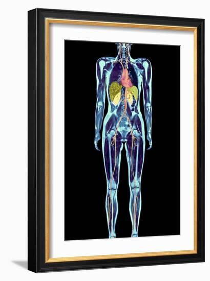 Full Body Scan, MRI Scan-Volker Steger-Framed Photographic Print