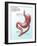 Gastric Bypass Surgery-Gwen Shockey-Framed Giclee Print