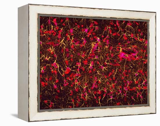 Glial Cells-Thomas Deerinck-Framed Premier Image Canvas