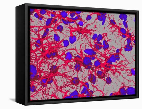 Glial Cells-Thomas Deerinck-Framed Premier Image Canvas