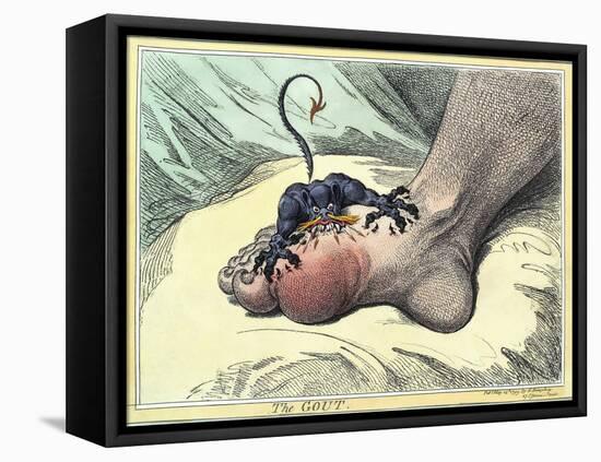 Gout, 18th-century Caricature-Miriam and Ira Wallach-Framed Premier Image Canvas