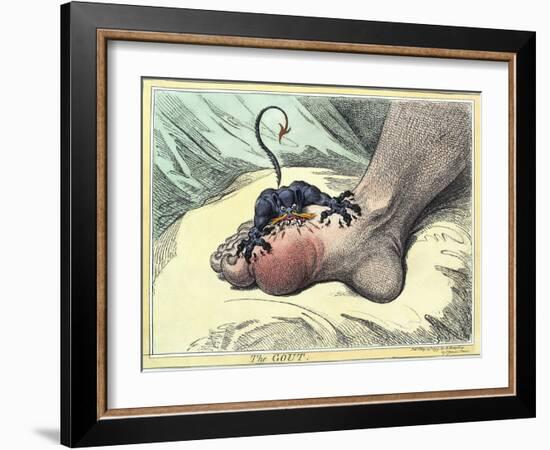 Gout, 18th-century Caricature-Miriam and Ira Wallach-Framed Premium Photographic Print