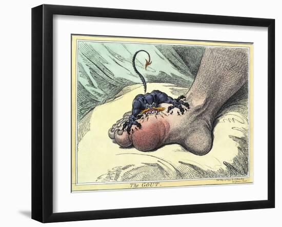 Gout, 18th-century Caricature-Miriam and Ira Wallach-Framed Photographic Print