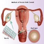 Methods of Female Birth Control-Gwen Shockey-Giclee Print