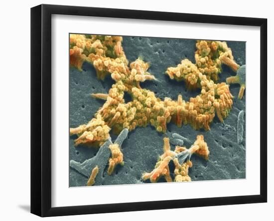 H1N1 Swine Flu Virus, SEM-Science Photo Library-Framed Photographic Print