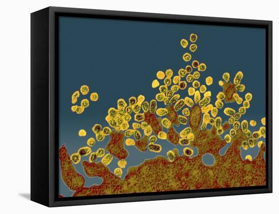 H1N1 Swine Flu Virus, TEM-Dr. Klaus Boller-Framed Premier Image Canvas