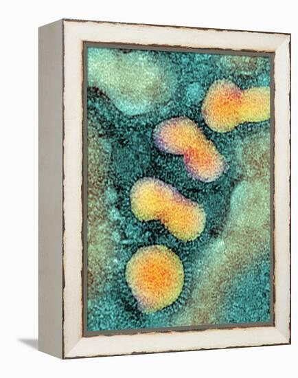 H5N1 Avian Influenza Virus Particles, TEM-NIBSC-Framed Premier Image Canvas