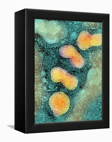 H5N1 Avian Influenza Virus Particles, TEM-NIBSC-Framed Premier Image Canvas