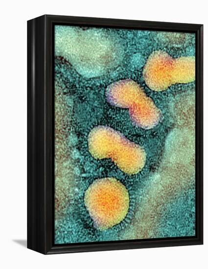 H5N1 Avian Influenza Virus Particles, TEM-NIBSC-Framed Premier Image Canvas