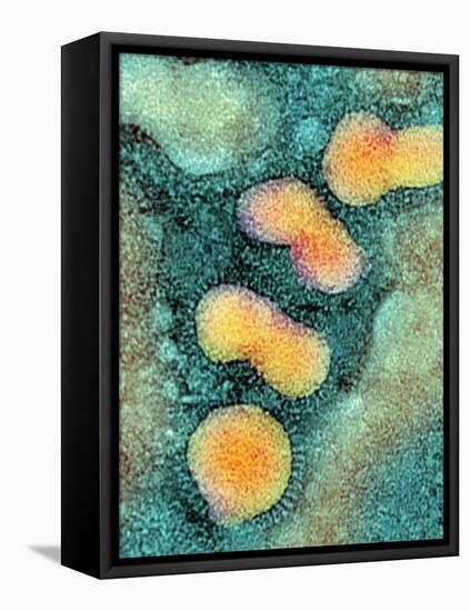 H5N1 Avian Influenza Virus Particles, TEM-NIBSC-Framed Premier Image Canvas