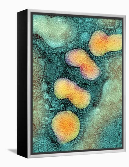 H5N1 Avian Influenza Virus Particles, TEM-NIBSC-Framed Premier Image Canvas