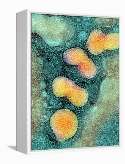 H5N1 Avian Influenza Virus Particles, TEM-NIBSC-Framed Premier Image Canvas