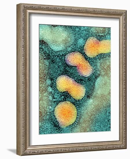 H5N1 Avian Influenza Virus Particles, TEM-NIBSC-Framed Photographic Print