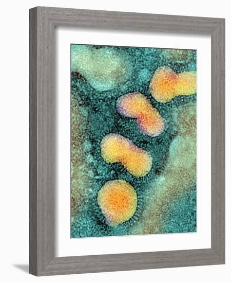 H5N1 Avian Influenza Virus Particles, TEM-NIBSC-Framed Photographic Print