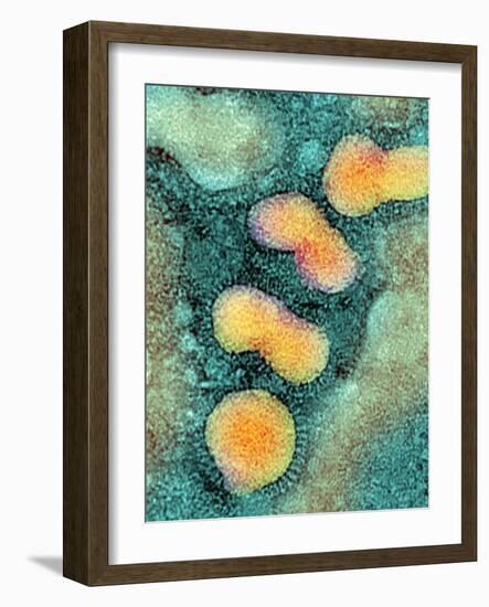 H5N1 Avian Influenza Virus Particles, TEM-NIBSC-Framed Photographic Print