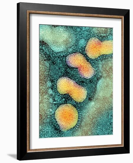 H5N1 Avian Influenza Virus Particles, TEM-NIBSC-Framed Photographic Print