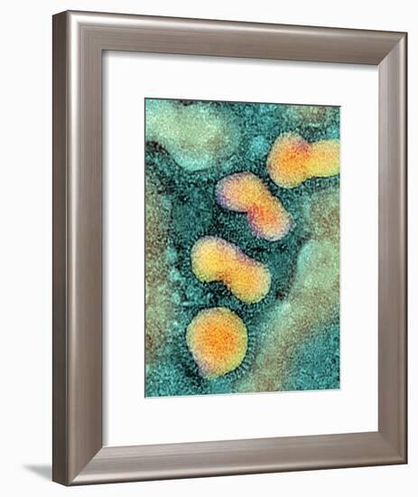 H5N1 Avian Influenza Virus Particles, TEM-NIBSC-Framed Photographic Print