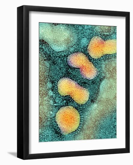 H5N1 Avian Influenza Virus Particles, TEM-NIBSC-Framed Photographic Print