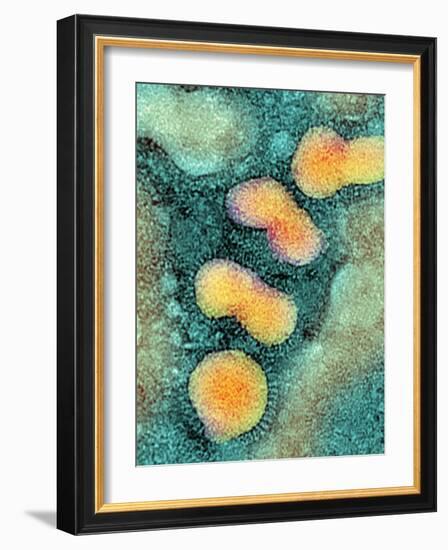 H5N1 Avian Influenza Virus Particles, TEM-NIBSC-Framed Photographic Print