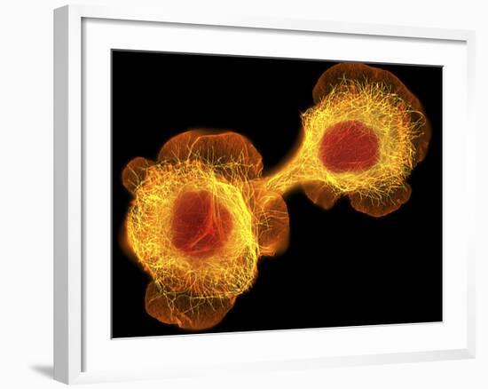 HaCaT Culture Cells, Light Micrograph-Dr. Torsten Wittmann-Framed Photographic Print