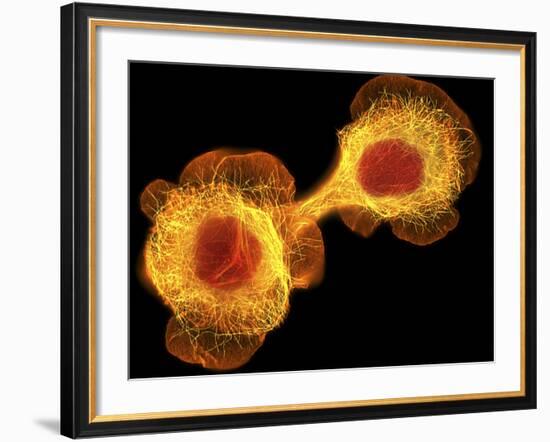 HaCaT Culture Cells, Light Micrograph-Dr. Torsten Wittmann-Framed Photographic Print