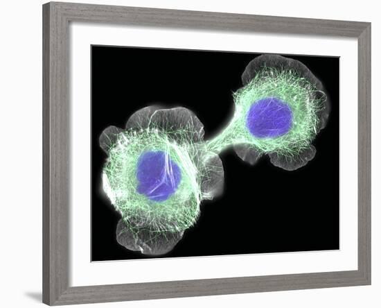 HaCaT Culture Cells, Light Micrograph-Dr. Torsten Wittmann-Framed Photographic Print