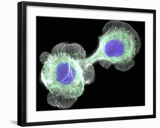 HaCaT Culture Cells, Light Micrograph-Dr. Torsten Wittmann-Framed Photographic Print