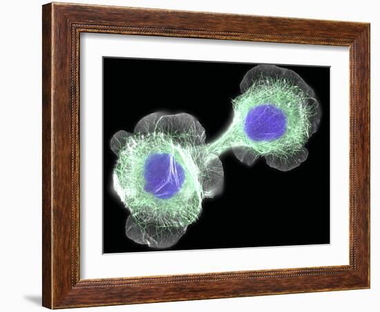 HaCaT Culture Cells, Light Micrograph-Dr. Torsten Wittmann-Framed Photographic Print