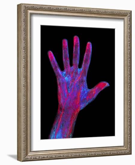 Hand Blood Supply, Artwork-Mehau Kulyk-Framed Photographic Print