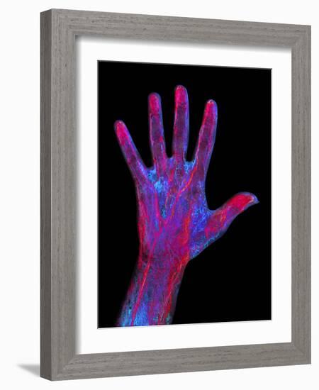 Hand Blood Supply, Artwork-Mehau Kulyk-Framed Photographic Print