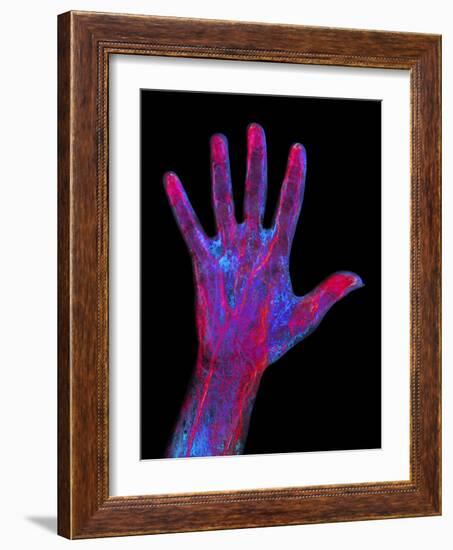 Hand Blood Supply, Artwork-Mehau Kulyk-Framed Photographic Print