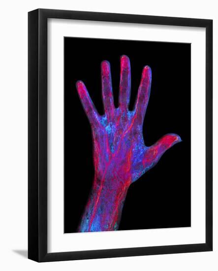 Hand Blood Supply, Artwork-Mehau Kulyk-Framed Photographic Print