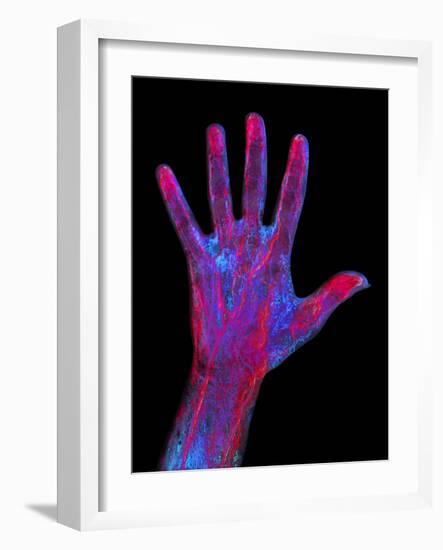 Hand Blood Supply, Artwork-Mehau Kulyk-Framed Photographic Print