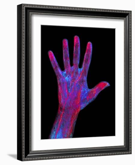 Hand Blood Supply, Artwork-Mehau Kulyk-Framed Photographic Print