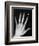 Hand Bones-Simon Jarratt-Framed Photographic Print