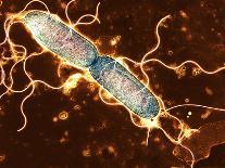Spirochete Bacteria, TEM-Hazel Appleton-Framed Premier Image Canvas