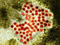 Paramyxovirus, TEM-Hazel Appleton-Photographic Print